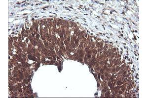 Image no. 6 for anti-Cancer/testis Antigen 1B (CTAG1B) antibody (ABIN1499895)