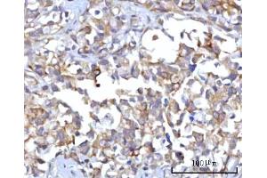 IHC analysis of RAP1GAP using anti-RAP1GAP antibody (ABIN7599729). (RAP1GAP antibody  (AA 11-661))