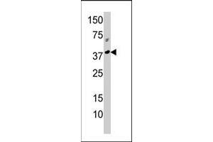 Western blot analysis of RCL1 polyclonal antibody  in A-375 cell line lysate (35 ug/lane). (RCL1 antibody  (N-Term))