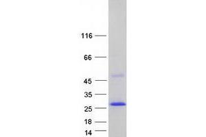 Western Blotting (WB) image for Sarcospan (Kras Oncogene-Associated Gene) (SSPN) (Transcript Variant 2) protein (Myc-DYKDDDDK Tag) (ABIN2731403)