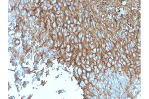 Formalin-fixed, paraffin-embedded human Bladder stained with GLUT-1 Mouse Monoclonal Antibody (rGLUT1/2476). (Recombinant GLUT1 antibody  (AA 203-305))