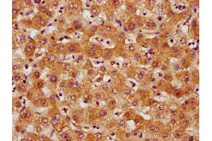 IHC image of ABIN7148683 diluted at 1:500 and staining in paraffin-embedded human liver tissue performed on a Leica BondTM system.