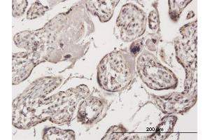 Immunoperoxidase of purified MaxPab antibody to ZNF584 on formalin-fixed paraffin-embedded human placenta.
