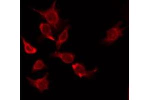ABIN6276174 staining HuvEc by IF/ICC. (OR5P2 antibody  (Internal Region))