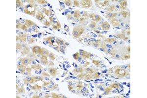 Immunohistochemistry of paraffin-embedded Human stomach using SPATA4 Polyclonal Antibody at dilution of 1:100 (40x lens). (SPATA4 antibody)