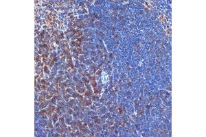 Immunohistochemistry of paraffin-embedded mouse spleen using PI3 Kinase p110 delta Rabbit mAb (ABIN7269326) at dilution of 1:100 (40x lens). (PIK3CD antibody)
