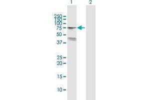 Western Blot analysis of ZSCAN18 expression in transfected 293T cell line by ZSCAN18 MaxPab polyclonal antibody. (ZSCAN18 antibody  (AA 1-510))