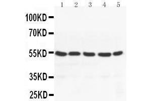 Anti-PPAR gamma antibody, Western blotting Lane 1: MM453 Cell Lysate Lane 2: MM231 Cell Lysate Lane 3: HELA Cell Lysate Lane 4: JURKAT Cell Lysate Lane 5:  Cell Lysate