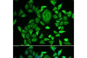 Immunofluorescence analysis of MCF-7 cells using RBP3 Polyclonal Antibody (RBP3 antibody)
