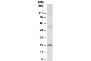 Western blot testing of human kidney lysate with MAD4 antibody at 0. (MXD4 antibody)