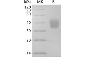 Western Blotting (WB) image for Interleukin 4 Receptor (IL4R) protein (His tag) (ABIN7320921) (IL4 Receptor Protein (His tag))