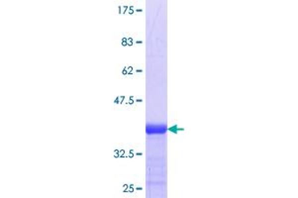 ADAMTS18 Protein (AA 942-1047) (GST tag)