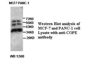 Image no. 2 for anti-Coatomer Protein Complex, Subunit epsilon (COPE) antibody (ABIN791222) (COPE antibody)