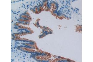 Used in DAB staining on fromalin fixed paraffin- embedded bronchus tissue (VPREB1 antibody  (AA 43-128))