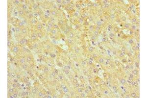 Immunohistochemistry of paraffin-embedded human liver tissue using ABIN7142463 at dilution of 1:100 (ABAT antibody  (AA 29-300))