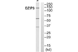 Immunohistochemistry analysis of paraffin-embedded human breast carcinoma tissue, using DZIP3 antibody. (DZIP3 antibody)
