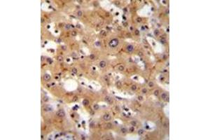 Formalin fixed and paraffin embedded human liver tissue reacted with GGCX Antibody (Center) followed by peroxidase conjugation of the secondary antibody and DAB staining.