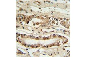 Immunohistochemistry analysis in formalin fixed and paraffin embedded lung tissue reacted with FOXP1 Antibody (C-term) followed by peroxidase conjugation of the secondary antibody and DAB staining.