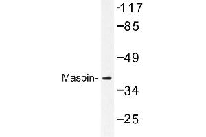 Image no. 1 for anti-serpin Peptidase Inhibitor, Clade B (Ovalbumin), Member 5 (SERPINB5) antibody (ABIN272300) (SERPINB5 antibody)