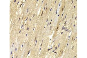 Immunohistochemistry of paraffin-embedded Mouse heart using TOPBP1 Polyclonal Antibody at dilution of 1:100 (40x lens). (TOPBP1 antibody)
