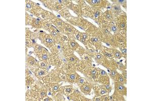 Immunohistochemistry of paraffin-embedded human liver injury using TMED10 antibody at dilution of 1:100 (x40 lens).