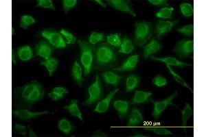 Immunofluorescence of monoclonal antibody to MAPK12 on HeLa cell. (MAPK12 antibody  (AA 251-367))