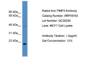 WB Suggested Anti-TIMP3  Antibody Titration: 0.