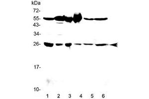 Western blot testing of 1) rat testis, 2) rat brain, 3) mouse testis, 4) mouse brain, 5) human HeLa and 6) human MCF7 lysate with GSTM3 antibody at 0.