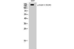 Western Blotting (WB) image for anti-Receptor Tyrosine-Protein Kinase ErbB-3 (ERBB3) (pTyr1197) antibody (ABIN3182375) (ERBB3 antibody  (pTyr1197))