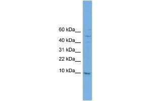 WB Suggested Anti-COX7B Antibody Titration: 0. (COX7B antibody  (N-Term))