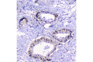 IHC analysis of CFP using anti-CFP antibody (ABIN6719298). (CFP antibody)