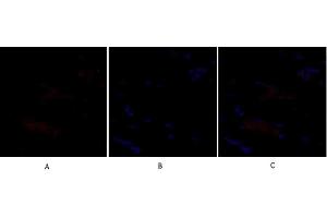 Immunofluorescence analysis of rat heart tissue. (SNAIL antibody)