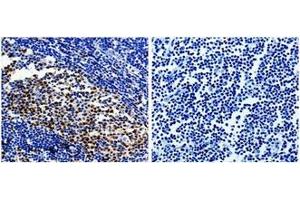 The image on the left is immunohistochemistry of paraffin-embedded Human tonsil tissue using 31002 (PCNA Antibody) at dilution 1/25, on the right is treated with the fusion protein. (PCNA antibody  (AA 9-252))