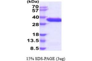 SDS-PAGE (SDS) image for Complement Factor B (CFB) (AA 26-259) protein (His tag) (ABIN5854833) (Complement Factor B Protein (CFB) (AA 26-259) (His tag))