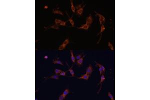 Immunofluorescence analysis of C6 cells using IQG Polyclonal Antibody (ABIN7268020) at dilution of 1:100 (40x lens). (IQGAP1 antibody  (AA 500-750))