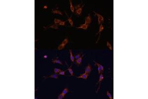 Immunofluorescence analysis of C6 cells using IQG Polyclonal Antibody (ABIN7268020) at dilution of 1:100 (40x lens).
