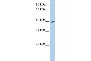 WB Suggested Anti-MEIS3 Antibody Titration:  0. (MEIS3 antibody  (Middle Region))