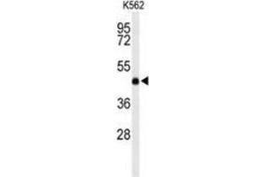 Western blot analysis of LCAT (arrow) in K562 cell line lysates (35ug/lane) using LCAT 
