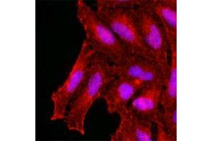 Immunofluorescence of human HeLa cells stained with KCTD15 monoclonal antibody, clone AT4C3  (1 : 500) with Texas Red (Red). (KCTD15 antibody  (AA 1-234))