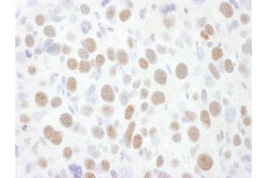 Immunohistochemistry (IHC) image for anti-Cyclin-Dependent Kinase 9 (CDK9) (AA 322-372) antibody (ABIN7453621) (CDK9 antibody  (AA 322-372))