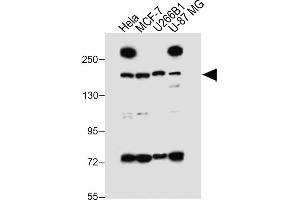 All lanes : Anti-UTY_HUN at 1:1000 dilution Lane 1: Hela whole cell lysate Lane 2: MCF-7 whole cell lysate Lane 3: U266B1 whole cell lysate Lane 4: U-87 MG whole cell lysate Lysates/proteins at 20 μg per lane. (UTY antibody  (C-Term))