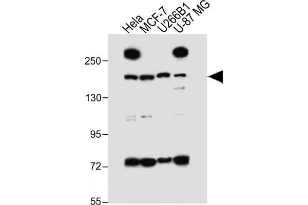 UTY antibody  (C-Term)
