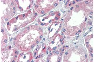 Human Kidney (formalin-fixed, paraffin-embedded) stained with TRIM68 antibody ABIN462217 followed by biotinylated goat anti-rabbit IgG secondary antibody ABIN481713, alkaline phosphatase-streptavidin and chromogen. (TRIM68 antibody  (AA 395-444))