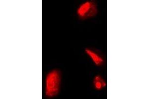 Immunofluorescent analysis of RPS5 staining in Hela cells.
