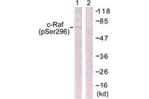Western blot analysis of extracts from 293 cells treated with PMA 125ng/ml 30' , using C-RAF (Phospho-Ser296) Antibody.