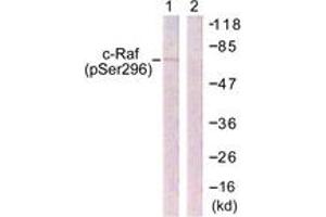 Western blot analysis of extracts from 293 cells treated with PMA 125ng/ml 30' , using C-RAF (Phospho-Ser296) Antibody. (RAF1 antibody  (pSer296))