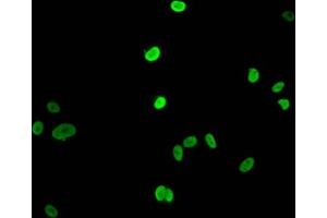 Immunofluorescent analysis of MCF-7 cells (sodium butyrate, 30 mM, 4h) using ABIN7139163 at dilution of 1:100 and Alexa Fluor 488-congugated AffiniPure Goat Anti-Rabbit IgG(H+L) (HIST1H1E antibody  (acLys16))