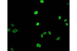 Immunofluorescent analysis of MCF-7 cells (sodium butyrate, 30 mM, 4h) using ABIN7139163 at dilution of 1:100 and Alexa Fluor 488-congugated AffiniPure Goat Anti-Rabbit IgG(H+L)