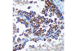 Immunohistochemistry of paraffin-embedded Mouse testis using R Rabbit pAb (ABIN7269785) at dilution of 1:100 (40x lens). (RABGAP1 antibody  (AA 830-1069))