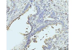 IHC analysis of RPL23 using anti-RPL23 antibody (ABIN7599808). (RPL23 antibody  (AA 12-136))